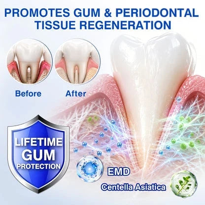 GumShield Periodontal Care Gel