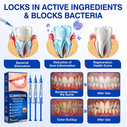 GumShield Periodontal Care Gel
