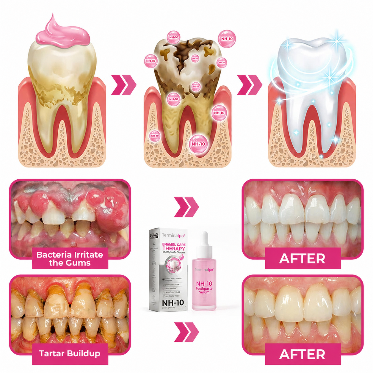 Terminalpo® Thismile NH-10 Enamel & Gum Advanced Therapy Toothpaste Serum