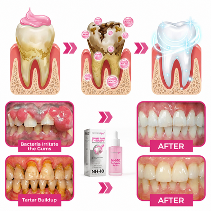 Terminalpo® Thismile NH-10 Enamel & Gum Advanced Therapy Toothpaste Serum