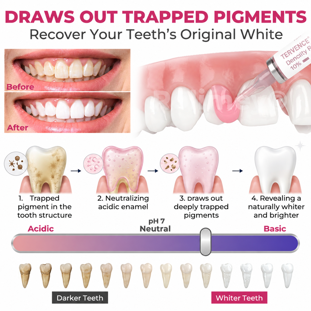 Tervence® Natural Enamel Restoration Gel for Cavity Repair